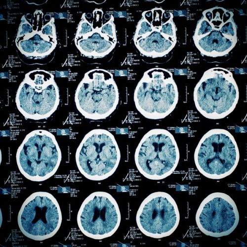 Pattern of human skull slices on MR imaging film concept