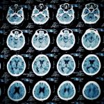 Pattern of human skull slices on MR imaging film concept